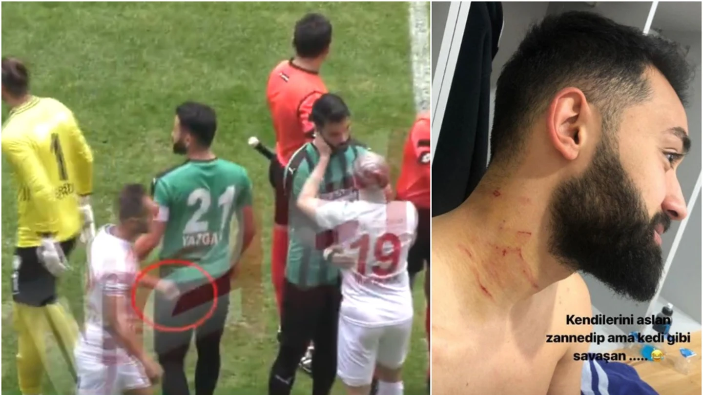 Mansur Calar sale al campo con una cuchilla y agrede a varios rivales Mansur Calar sale al campo con una cuchilla y agrede a varios rivales