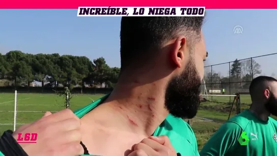 TurcoCuchillaL6D TurcoCuchillaL6D