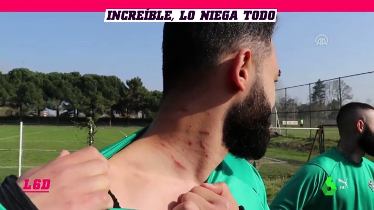 TurcoCuchillaL6D TurcoCuchillaL6D