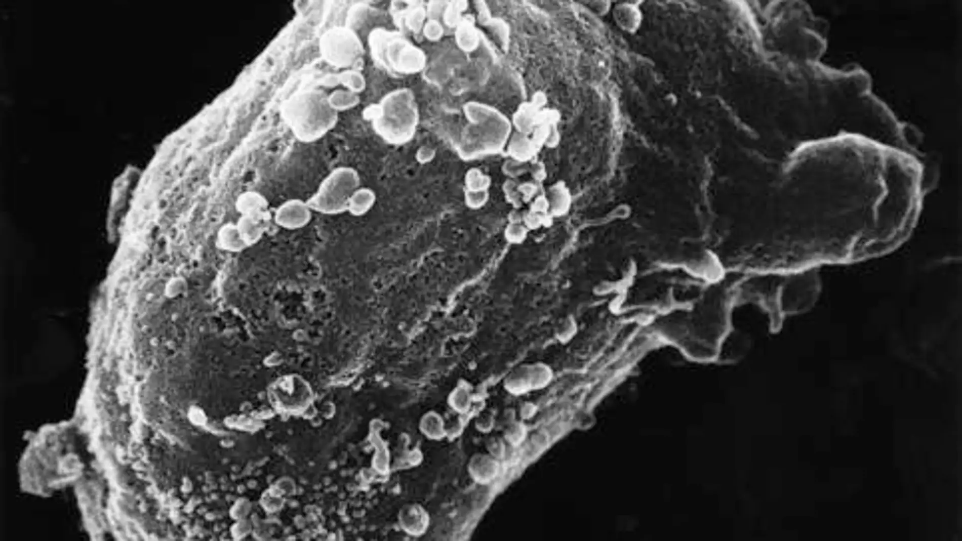 Vista al microscopio electrónico de un linfocito con VIH