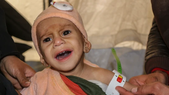 Solo la mirad de las instalaciones sanitarias están operativas y muchos niños sufren desnutrición. Solo la mirad de las instalaciones sanitarias están operativas y muchos niños sufren desnutrición.