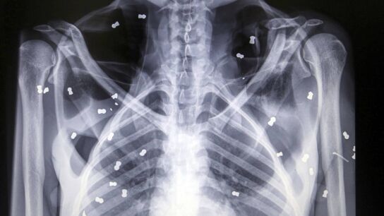 Radiografía que muestra la cantidad de perdigones que posee el primate.