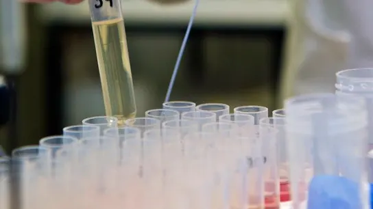 Una probeta en un laboratorio Una probeta en un laboratorio