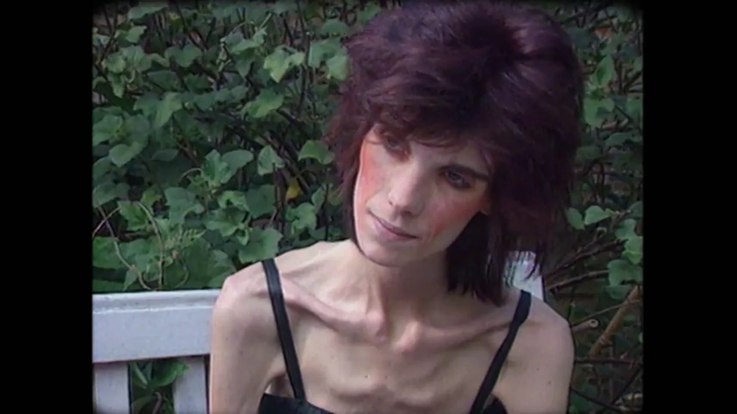 Así se trataba la anorexia en los años 90: "Le dijeron a mi madre que no tenía ningún problema, que lo único que pasaba es que no comía bien" Así se trataba la anorexia en los años 90: "Le dijeron a mi madre que no tenía ningún problema, que lo único que pasaba es que no comía bien"
