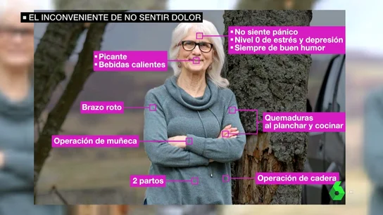 Jo Cameron, la mujer incapaz de sentir dolor y miedo por una mutación genética Jo Cameron, la mujer incapaz de sentir dolor y miedo por una mutación genética