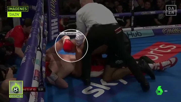Descalifican a un boxeador tras morder cuatro veces a su rival en pleno combate Descalifican a un boxeador tras morder cuatro veces a su rival en pleno combate