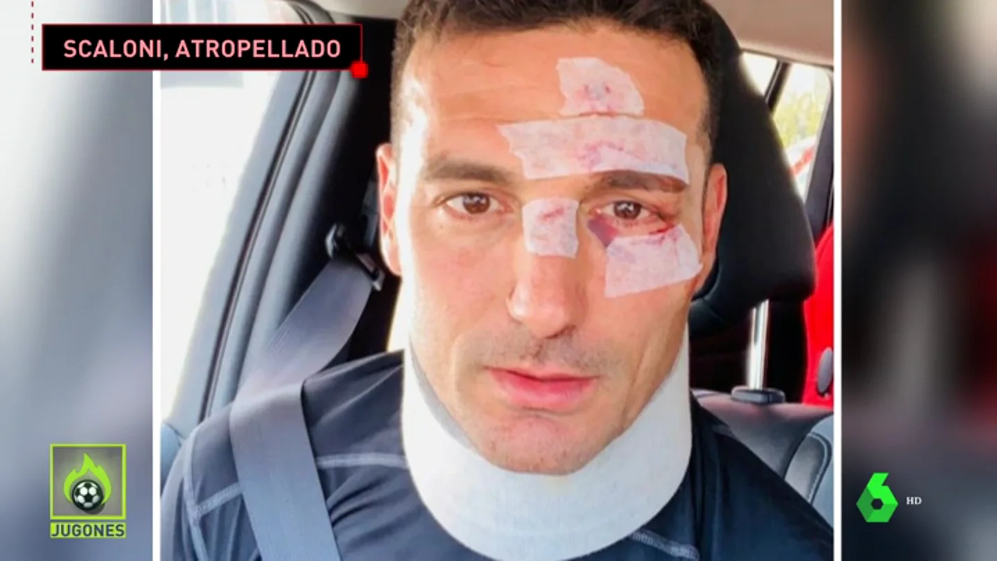Un coche atropella al seleccionador argentino Lionel Scaloni cuando iba en bicicleta por Mallorca Un coche atropella al seleccionador argentino Lionel Scaloni cuando iba en bicicleta por Mallorca