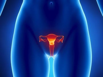 Cáncer de endometrio (Archivo) Cáncer de endometrio (Archivo)