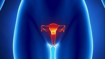 Cáncer de endometrio (Archivo)
