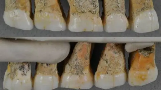 Dentadura del Homo luzonensis Dentadura del Homo luzonensis