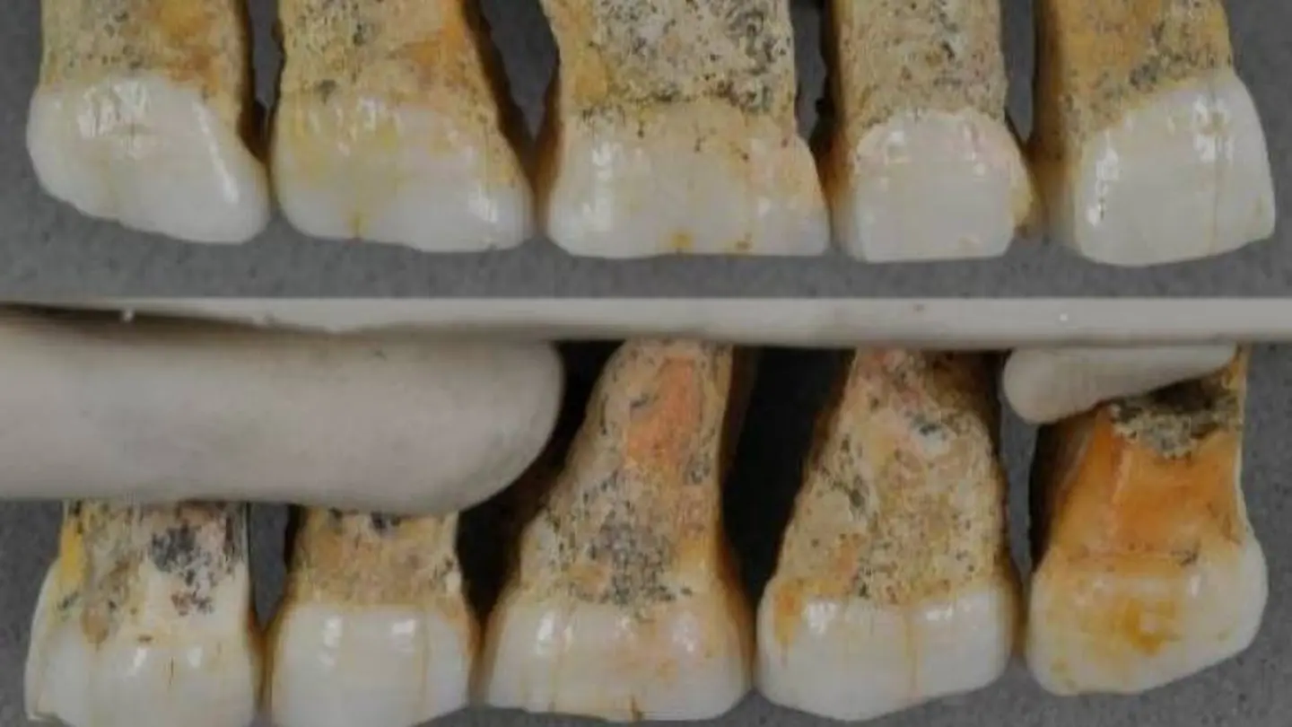 Dentadura del Homo luzonensis Dentadura del Homo luzonensis
