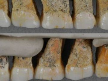 Dentadura del Homo luzonensis Dentadura del Homo luzonensis