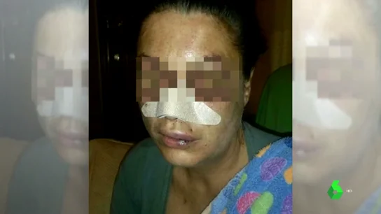 Una víctima de violencia machista teme no llegar viva al juicio: "He tenido que cambiar de casa tres veces" Una víctima de violencia machista teme no llegar viva al juicio: "He tenido que cambiar de casa tres veces"