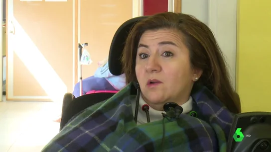 ESCLEROSIS ESCLEROSIS