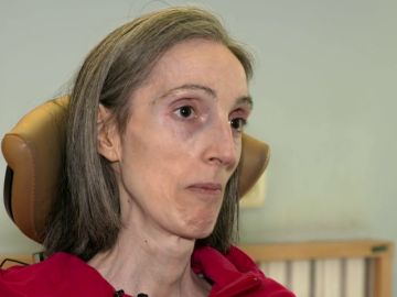 Larraitz, enferma de ELA Larraitz, enferma de ELA