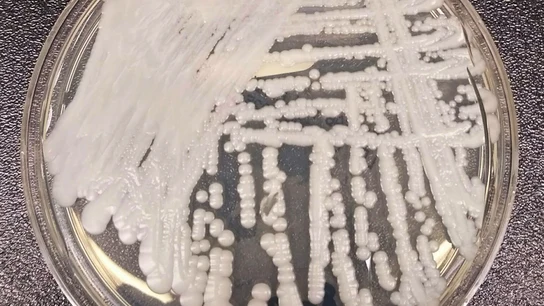 El hongo 'Candida auris' cultivado en los Centros para el Control y la prevención de Enfermedades (CDC) El hongo 'Candida auris' cultivado en los Centros para el Control y la prevención de Enfermedades (CDC)