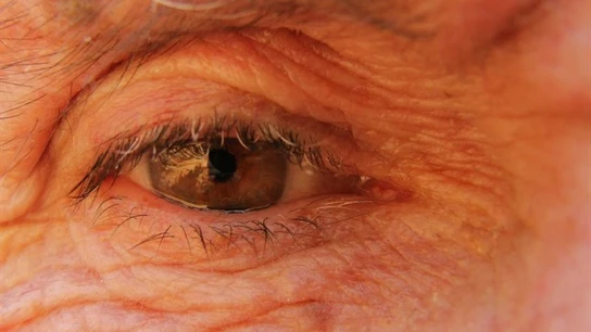 Imagen de archivo del ojo de una persona mayor Imagen de archivo del ojo de una persona mayor