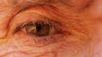 Imagen de archivo del ojo de una persona mayor