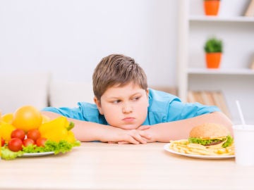 Obesidad infantil Obesidad infantil