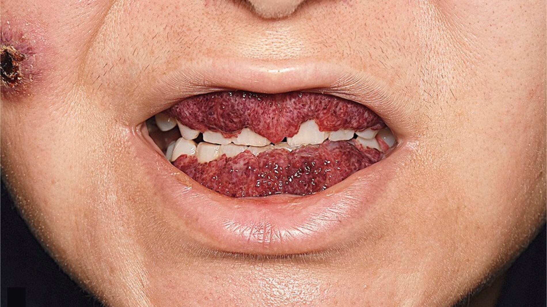 Si encuentras una imagen como esta en el espejo, no dudes en buscar la ayuda de un especialista