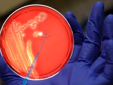 Diseñan una 'bomba genética programable' capaz de matar solo bacterias malas Diseñan una 'bomba genética programable' capaz de matar solo bacterias malas