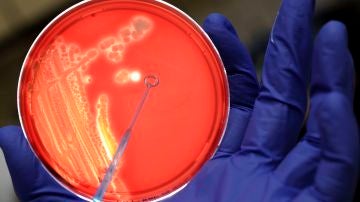 Diseñan una 'bomba genética programable' capaz de matar solo bacterias malas