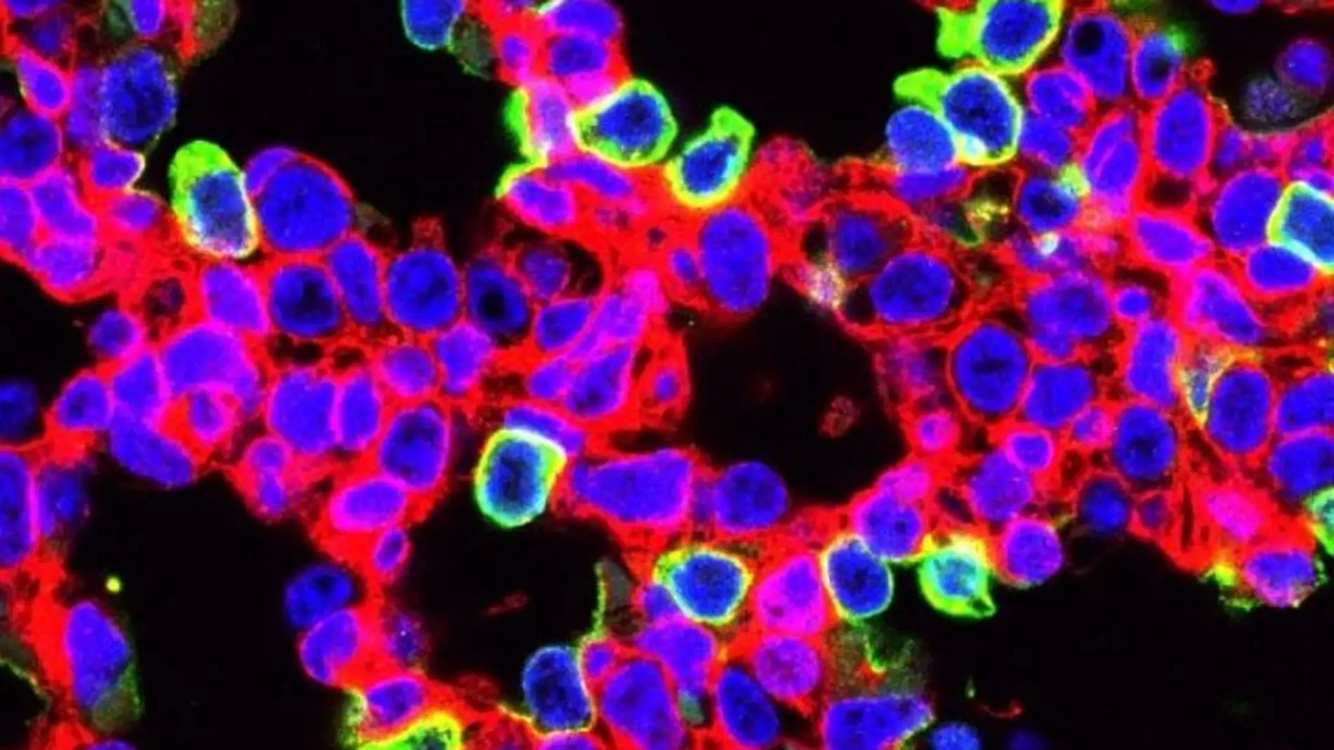 Nueva terapia con CRISPR para curar una enfermedad pulmonar mortal en ratones