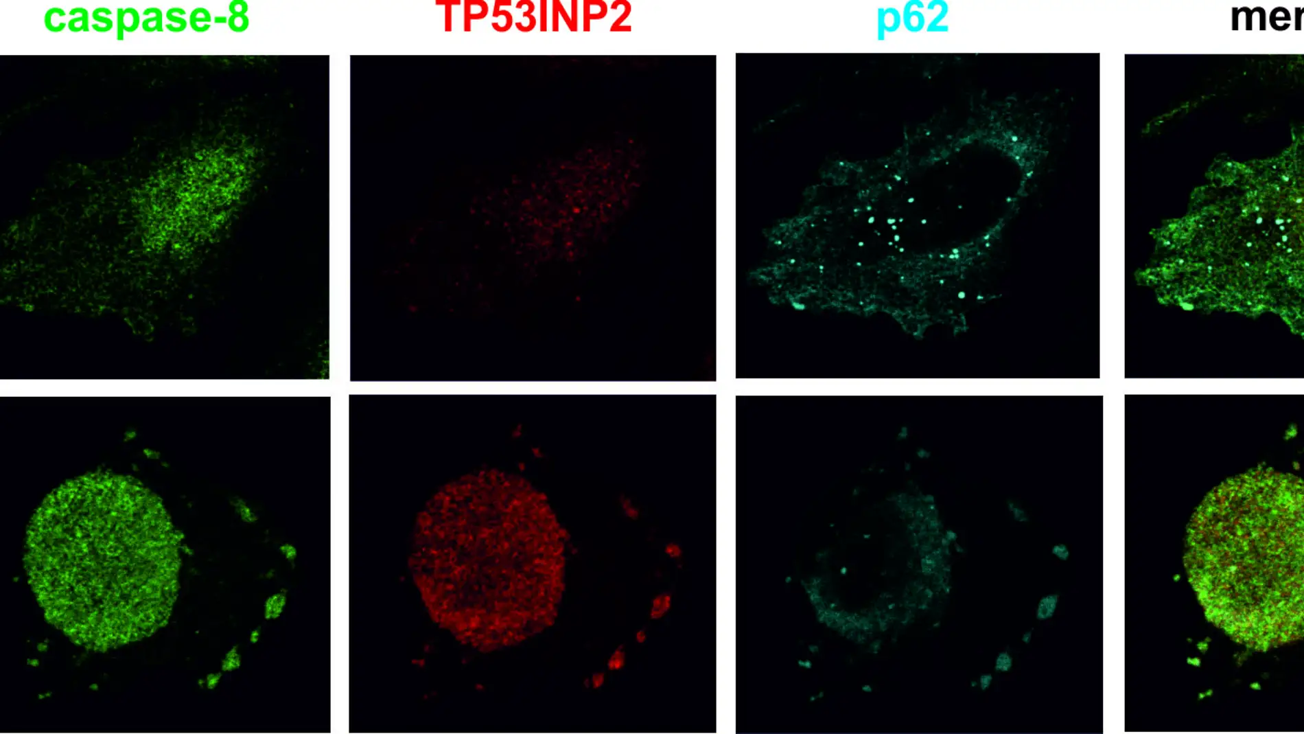 Diferentes localizaciones de las proteínas involucradas en apoptosis