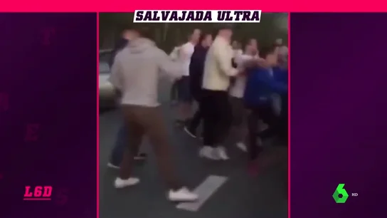 ultrasRusia_L6D ultrasRusia_L6D