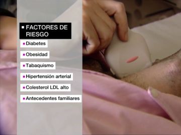 ¿Cómo se produce un ictus?: estas son sus causas y secuelas ¿Cómo se produce un ictus?: estas son sus causas y secuelas