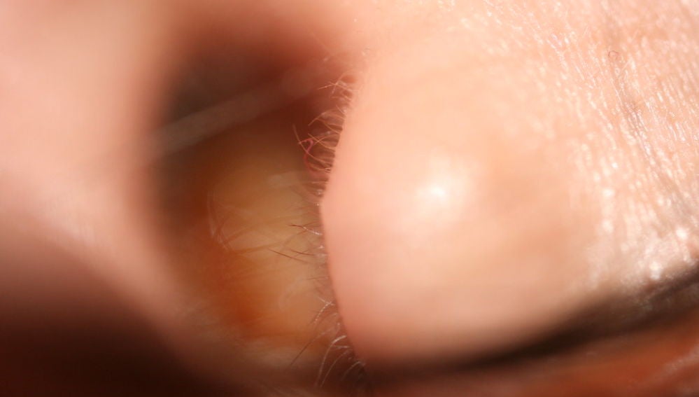 El oído produce cera para limpiar el conducto auditivo 