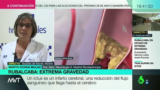 Ictus: si ves alguno de estos síntomas, llama al 112 Ictus: si ves alguno de estos síntomas, llama al 112