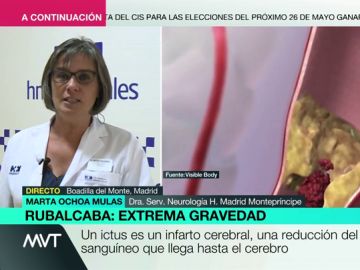 Ictus: si ves alguno de estos síntomas, llama al 112 Ictus: si ves alguno de estos síntomas, llama al 112