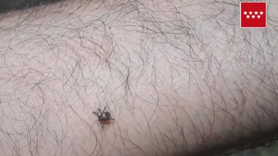 Imagen de una garrapata en un brazo Imagen de una garrapata en un brazo