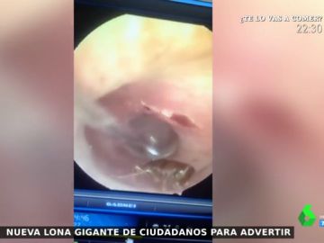Acude al médico por un dolor de cabeza y descubre que tiene una cucaracha viviendo en el oído Acude al médico por un dolor de cabeza y descubre que tiene una cucaracha viviendo en el oído