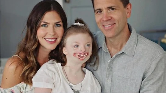Muere la pequeña Sophia, un ejemplo de la lucha contra el odio a las personas con malformaciones Muere la pequeña Sophia, un ejemplo de la lucha contra el odio a las personas con malformaciones
