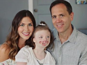 Muere la pequeña Sophia, un ejemplo de la lucha contra el odio a las personas con malformaciones Muere la pequeña Sophia, un ejemplo de la lucha contra el odio a las personas con malformaciones
