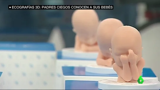 Ecografías 3D o cómo los padres ciegos pueden saber cómo será su bebé antes de que nazca Ecografías 3D o cómo los padres ciegos pueden saber cómo será su bebé antes de que nazca