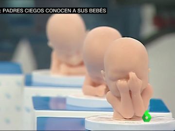 Ecografías 3D o cómo los padres ciegos pueden saber cómo será su bebé antes de que nazca Ecografías 3D o cómo los padres ciegos pueden saber cómo será su bebé antes de que nazca