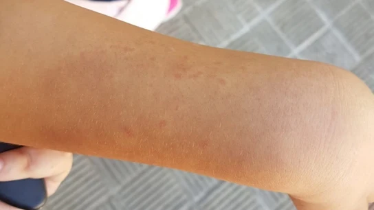 La niña comenzó a autolesionarse como fruto del estrés que vivía en el centro La niña comenzó a autolesionarse como fruto del estrés que vivía en el centro