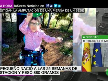 pierna pierna