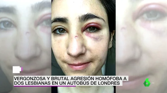 Un grupo de jóvenes propina una brutal paliza a dos lesbianas en Londres: "Solo veía mi sangre" Un grupo de jóvenes propina una brutal paliza a dos lesbianas en Londres: "Solo veía mi sangre"