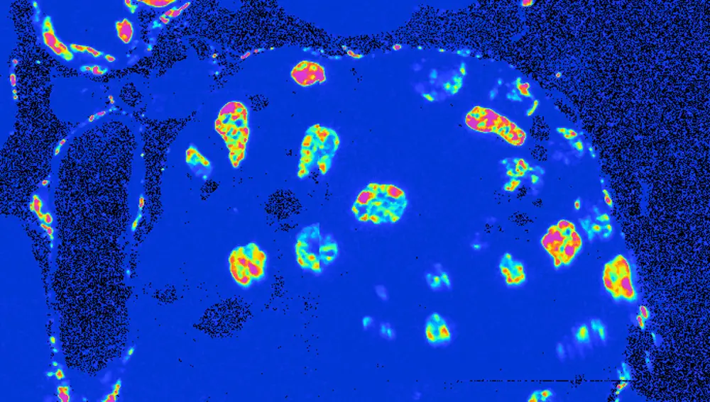 Imagen que muestra células jóvenes (azul-verde) y antiguas (amarillo-rosa) en un islote de Langerhans.