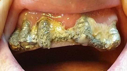 El estado que llegó a presentar la boca de la denunciante El estado que llegó a presentar la boca de la denunciante