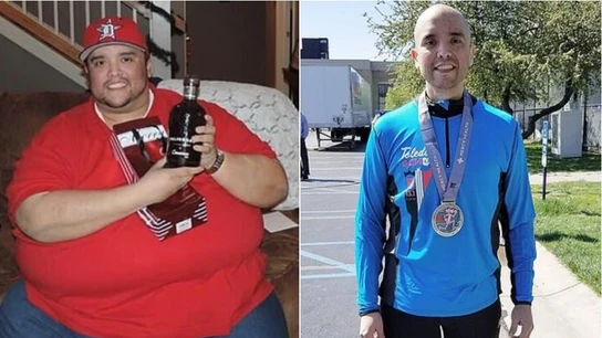 Carlos Orosco antes y después Carlos Orosco antes y después