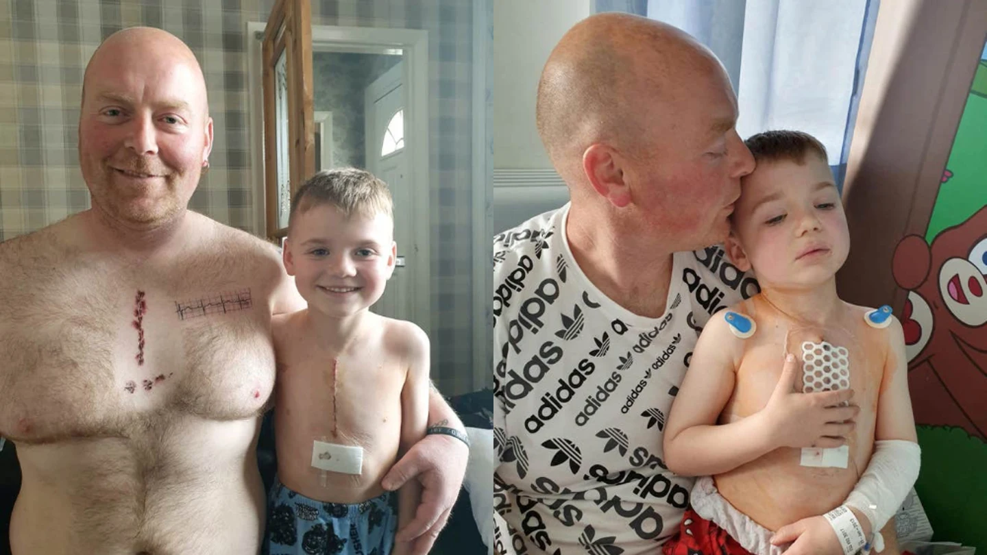 Padre e hijo posan con sus "cicatrices" después de la operación del pequeño. Padre e hijo posan con sus "cicatrices" después de la operación del pequeño.
