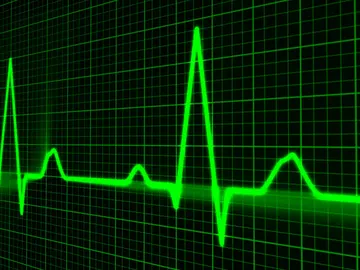 Pulso cardiaco Pulso cardiaco