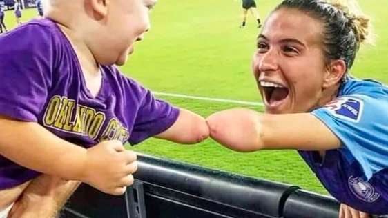 El saludo más emotivo entre un niño sin antebrazo y una futbolista con la misma discapacidad