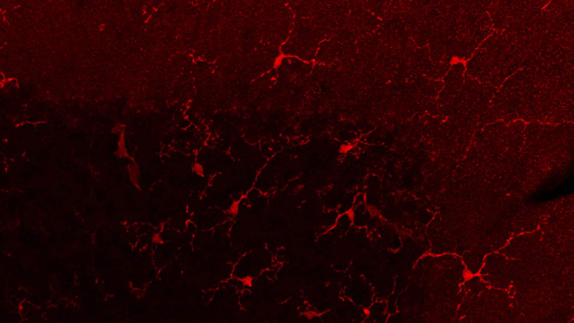 Imagen de microscopía que muestra células de la microglía en la corteza del cerebelo de ratón
