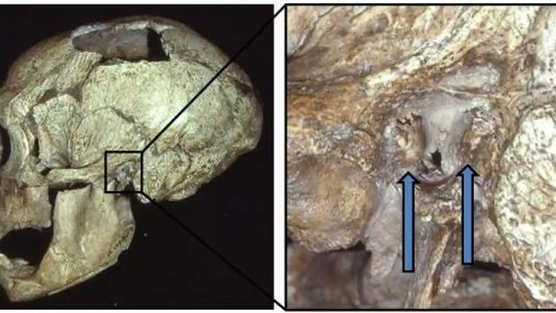 El oido de surfista era comun entre los neandertales